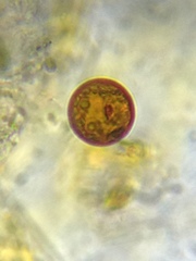 Trachelomonas cervicula