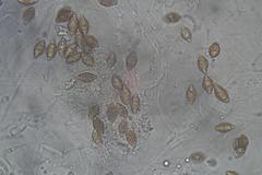 Austroboletus lacunosus