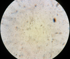 Strobilurus albipilatus