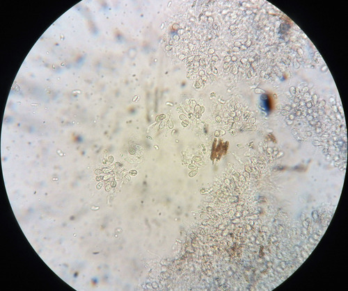 Sklaidžioji vaškaplutė nuotrauka