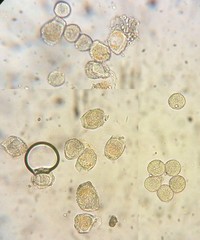 Puccinia caricina