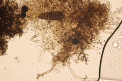 Berkleasmium concinnum