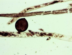 Vaucheria schleicheri