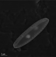Nitzschia communis