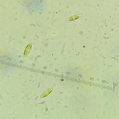Nitzschia communis