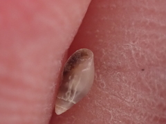 Leucophytia bidentata