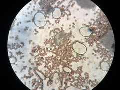 Fuligo septica candida