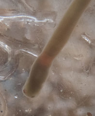 Maculaura cerebrosa