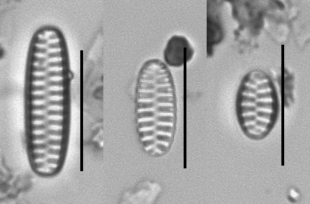 Staurosirella pinnata