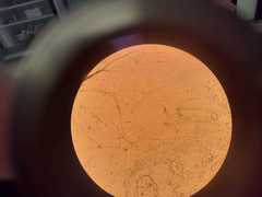 Penicillium digitatum