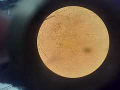 Penicillium digitatum