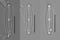 Encyonopsis hustedtii