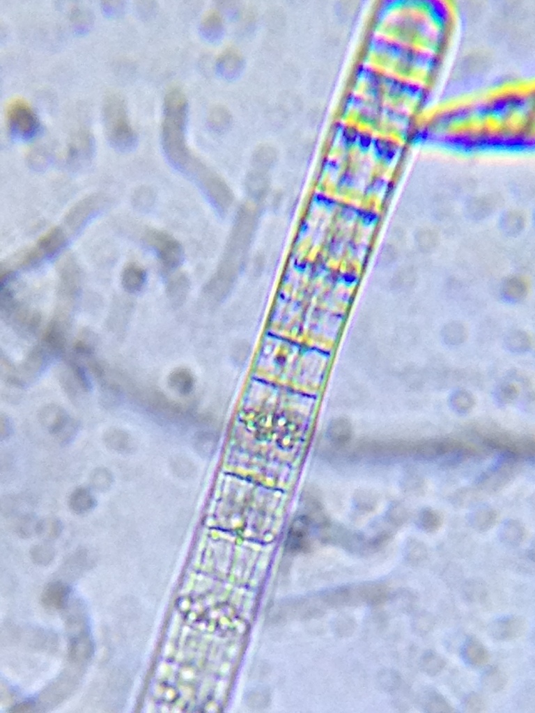Tychonema