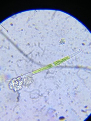 Closterium gracile