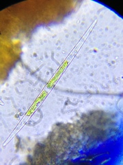 Closterium acutum