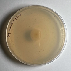 Phialemonium inflatum