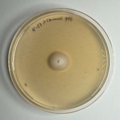 Phialemonium inflatum