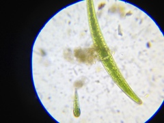 Closterium angustatum