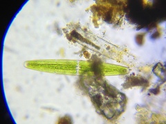 Netrium digitus