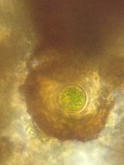 Arcella hemisphaerica