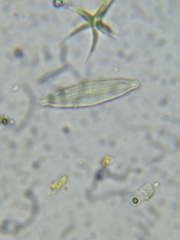 Tetradesmus lagerheimii