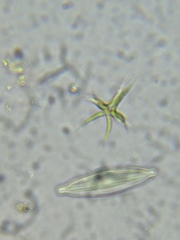 Tetradesmus lagerheimii