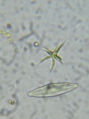 Tetradesmus lagerheimii