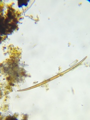 Closterium baillyanum