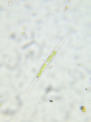 Closterium acutum