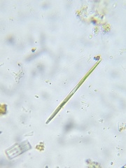Closterium acutum