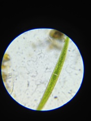 Closterium intermedium