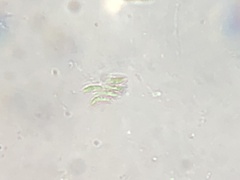 Tetradesmus