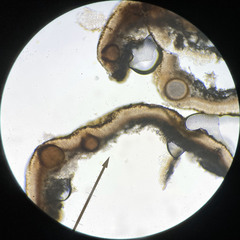 Didymocyrtis xanthomendozae