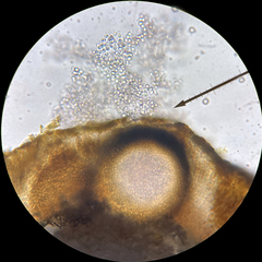 Didymocyrtis xanthomendozae