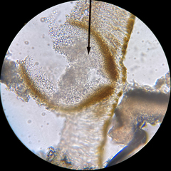 Didymocyrtis xanthomendozae
