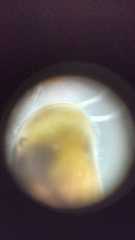 Cyprididae