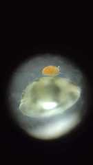 Ostracoda