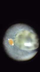 Ostracoda