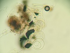 Helicomyces