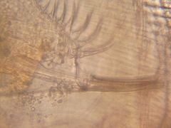 Simocephalus exspinosus