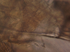 Simocephalus exspinosus