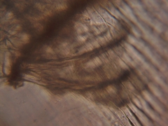 Simocephalus exspinosus