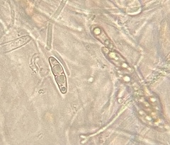 Byssosphaeria rhodomphala