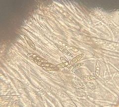 Byssosphaeria rhodomphala