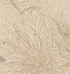 Byssosphaeria rhodomphala