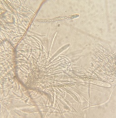 Byssosphaeria rhodomphala