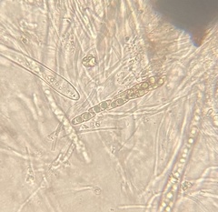 Byssosphaeria rhodomphala