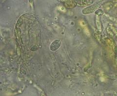 Cortinarius canarius