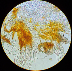 Arachnopeziza aurelia