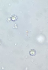 Lamprospora miniata